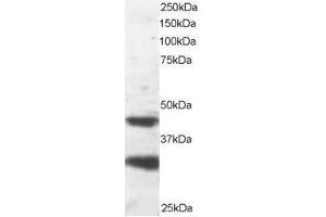 Image no. 1 for anti-Platelet-Activating Factor Acetylhydrolase 1b, Regulatory Subunit 1 (45kDa) (PAFAH1B1) (C-Term) antibody (ABIN374217) (PAFAH1B1 antibody  (C-Term))