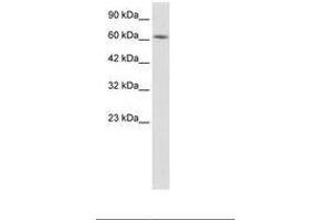 Image no. 1 for anti-Kelch-Like 28 (KLHL28) (AA 380-429) antibody (ABIN202773) (KLHL28 antibody  (AA 380-429))