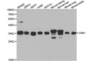 Western blot analysis of extracts of various cell lines, using CBR1 antibody (ABIN5973163) at 1/1000 dilution. (CBR1 antibody)