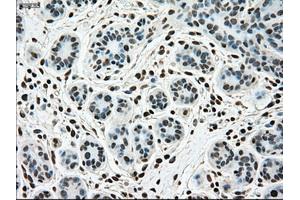 Immunohistochemical staining of paraffin-embedded breast tissue using anti-SSB mouse monoclonal antibody. (SSB antibody)