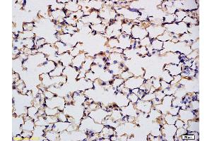 Formalin-fixed and paraffin embedded mouse embryo labeled with Anti Prkg1/cGKI Polyclonal Antibody, Unconjugated (ABIN720221) at 1:200 followed by conjugation to the secondary antibody and DAB staining (PRKG1 antibody)