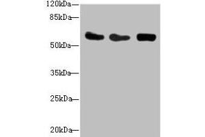 Western blot All lanes: CSRNP2 antibody at 2. (CSRNP2 antibody  (AA 324-543))