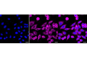anti-Annexin A7 (ANXA7) antibody