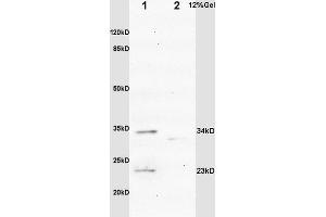 L1 rat brain lysates L2 mouse intestine lysates probed with Anti IGFBP6 Polyclonal Antibody, Unconjugated (ABIN753298) at 1:200 overnight at 4 °C. (IGFBP6 antibody  (AA 141-240))