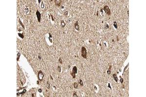 ABIN6266907 at 1/100 staining human brain tissue sections by IHC-P. (GUCY1B3 antibody  (N-Term))