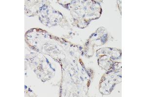 Immunohistochemistry of paraffin-embedded human placenta using SPON2 antibody (ABIN6129679, ABIN6148370, ABIN6148372 and ABIN6215647) at dilution of 1:100 (40x lens). (SPON2 antibody  (AA 27-150))