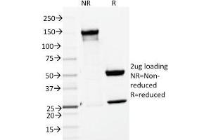 SDS-PAGE Analysis Purified ENAH / MENA Mouse Monoclonal Antibody (ENAH/1988). (ENAH antibody  (AA 485-589))