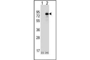 Western blot analysis of HIPK4 (arrow) using HIPK4 Antibody . (HIPK4 antibody)