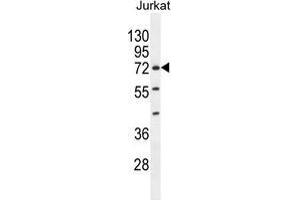 ZNF648 Antibody (N-term) western blot analysis in Jurkat cell line lysates (35 µg/lane).
