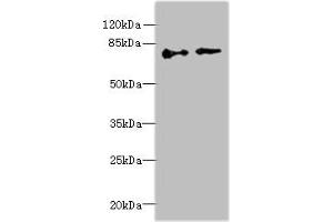 Western blot All lanes: ECD antibody at 6 μg/mL Lane 1: Hela whole cell lysate Lane 2: U251 whole cell lysate Secondary Goat polyclonal to rabbit IgG at 1/10000 dilution Predicted band size: 73, 68, 77 kDa Observed band size: 73 kDa (ECD/SGT1 antibody  (AA 1-300))