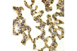 Immunohistochemistry (Paraffin-embedded Sections) (IHC (p)) image for anti-Retinoblastoma Binding Protein 4 (RBBP4) antibody (ABIN2989757)