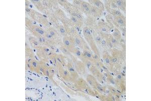 Immunohistochemistry of paraffin-embedded human liver using PTTG1 antibody. (PTTG1 antibody  (AA 1-202))
