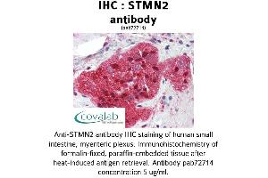 Image no. 1 for anti-Stathmin-Like 2 (STMN2) (N-Term) antibody (ABIN1739734) (STMN2 antibody  (N-Term))