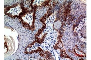 Immunohistochemistry (IHC) analysis of paraffin-embedded Human Skin, antibody was diluted at 1:100. (CLEC11A antibody)