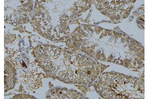 ABIN6269244 at 1/100 staining Mouse testis tissue by IHC-P. (MAP3K8 antibody  (Internal Region))
