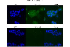 Sample Type: MCF7 Primary Antibody Dilution: 4 µg/mL Secondary Antibody: Anti-rabbit Alexa 546 Secondary Antibody Dilution:  µg/mL   Gene Name: BRCC3 (BRCC3 antibody  (C-Term))