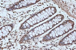 Immunohistochemistry of paraffin-embedded human colon using SRSF3 Rabbit mAb (ABIN7270216) at dilution of 1:100 (40x lens). (SRSF3 antibody)