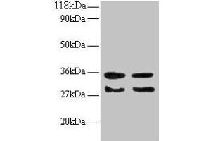 Western blot All lanes: TGFA antibody at 2 μg/mL Lane 1: EC109 whole cell lysate Lane 2: 293T whole cell lysate Secondary Goat polyclonal to rabbit IgG at 1/15000 dilution Predicted band size: 18, 17 kDa Observed band size: 30, 35 kDa (TGFA antibody  (AA 40-89))