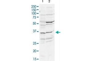 Western Blot analysis of mouse WT brain (A) and rat brain (B) tissue lysates with DLX2 polyclonal antibody  at 2 ug/mL working concentration. (DLX2 antibody  (N-Term))
