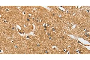 Immunohistochemistry of paraffin-embedded Human brain tissue using EPHB3 Polyclonal Antibody at dilution 1:40 (EPH Receptor B3 antibody)