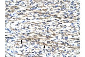 FHL2 antibody was used for immunohistochemistry at a concentration of 4-8 ug/ml to stain Myocardial cells (arrows) in Human Heart. (FHL2 antibody  (C-Term))