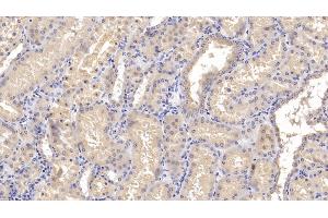 Immunohistochemistry (IHC) image for anti-Tumor Necrosis Factor Receptor Superfamily, Member 11b (TNFRSF11B) (AA 1-196) antibody (ABIN7431044)