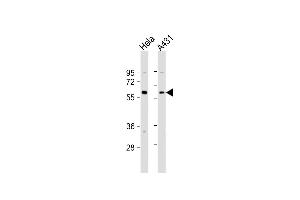 All lanes : Anti-Beclin-1 Antibody  at 1:4000 dilution Lane 1: Hela whole cell lysate Lane 2: A431 whole cell lysate Lysates/proteins at 20 μg per lane. (Beclin 1 antibody  (AA 210-239))