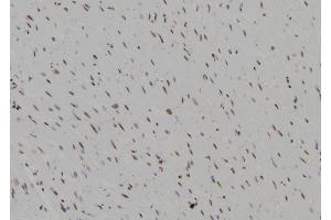 ABIN6273594 at 1/100 staining Rat heart tissue by IHC-P.