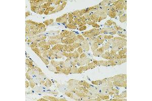 Immunohistochemistry of paraffin-embedded rat heart using RALBP1 antibody (ABIN5970488) at dilution of 1/100 (40x lens). (RALBP1 antibody)