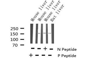 Western blot analysis of Phospho-EGFR (Tyr1092) expression in various lysates (EGFR antibody  (pTyr1097))