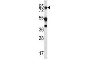 Western Blotting (WB) image for anti-Mucin 20, Cell Surface Associated (MUC20) (AA 654-684) antibody (ABIN3031869)