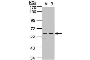 CCDC102B Antikörper