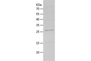 Western Blotting (WB) image for Proopiomelanocortin (POMC) (AA 27-267) protein (His tag) (ABIN7124601) (POMC Protein (AA 27-267) (His tag))