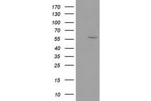 HEK293T cells were transfected with the pCMV6-ENTRY control (Left lane) or pCMV6-ENTRY DTNA (Right lane) cDNA for 48 hrs and lysed. (DTNA antibody)