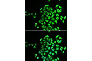 Immunofluorescence analysis of U2OS cells using NAPG antibody. (NAPG antibody  (AA 1-312))
