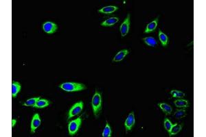 Immunofluorescence (IF) image for anti-Fc Fragment of IgG, Low Affinity IIa, Receptor (CD32) (FCGR2A) (AA 241-317) antibody (ABIN7158537)