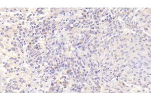 Immunohistochemistry (IHC) image for anti-Tumor Necrosis Factor Receptor Superfamily, Member 13C (TNFRSF13C) (AA 96-184) antibody (ABIN7438967)