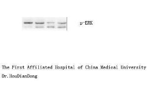 Western Blot (WB) analysis: Please contact us for more details. (ERK1/2 antibody  (pTyr204))