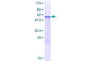 Ret Finger Protein-Like 3 (RFPL3) (AA 1-288) protein (GST tag)