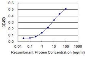 Detection limit for recombinant GST tagged LMTK3 is 0. (LMTK3 antibody  (AA 1151-1250))