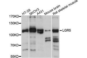 Western blot analysis of extracts of various cells, using LGR5 antibody. (LGR5 antibody)