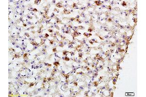 Formalin-fixed and paraffin embedded rat liver labeled with Anti-PCK2 Polyclonal Antibody, Unconjugated (ABIN708206) at 1:200 followed by conjugation to the secondary antibody and DAB staining (PEPCK antibody  (AA 365-470))