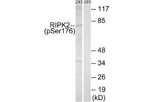 Western blot analysis of extracts from 293 cells, treated with UV (15 mins), using RIPK2 (Phospho-Ser176) antibody. (RIPK2 antibody  (pSer176))