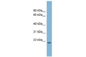 WB Suggested Anti-C4orf28 Antibody Titration: 0. (PACRGL antibody  (Middle Region))
