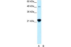 WB Suggested Anti-LASS2 Antibody Titration:  0. (Ceramide Synthase 2 antibody  (N-Term))