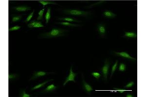 Immunofluorescence of monoclonal antibody to CALCOCO2 on HeLa cell. (CALCOCO2 antibody  (AA 347-446))