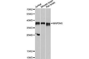 Western blot analysis of extracts of various cell lines, using MAP2K6 antibody. (MAP2K6 antibody)