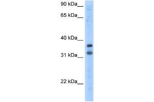 WB Suggested Anti-KCNRG Antibody Titration:  2. (KCNRG antibody  (N-Term))