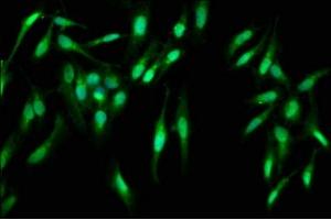 Immunofluorescence staining of Hela cells with ABIN7146938 at 1:400, counter-stained with DAPI. (Caspase 2 antibody  (AA 2-452))