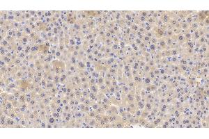 Detection of GPX1 in Mouse Liver Tissue using Polyclonal Antibody to Glutathione Peroxidase 1 (GPX1) (Glutathione Peroxidase 1 antibody  (AA 48-201))